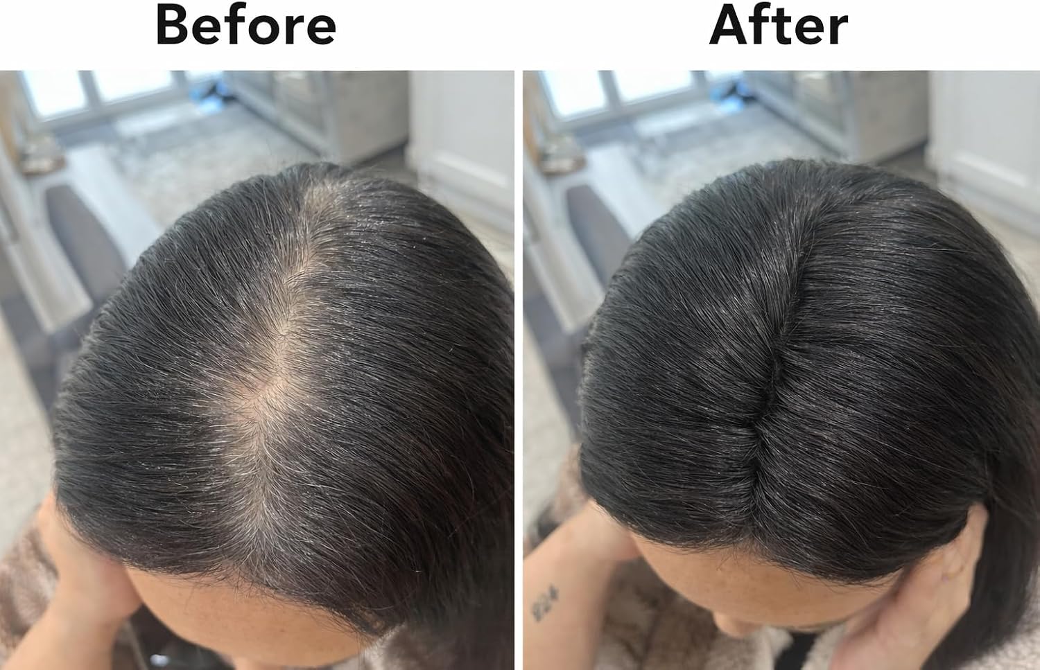 Before and after comparison of hair treatment on a person's head.