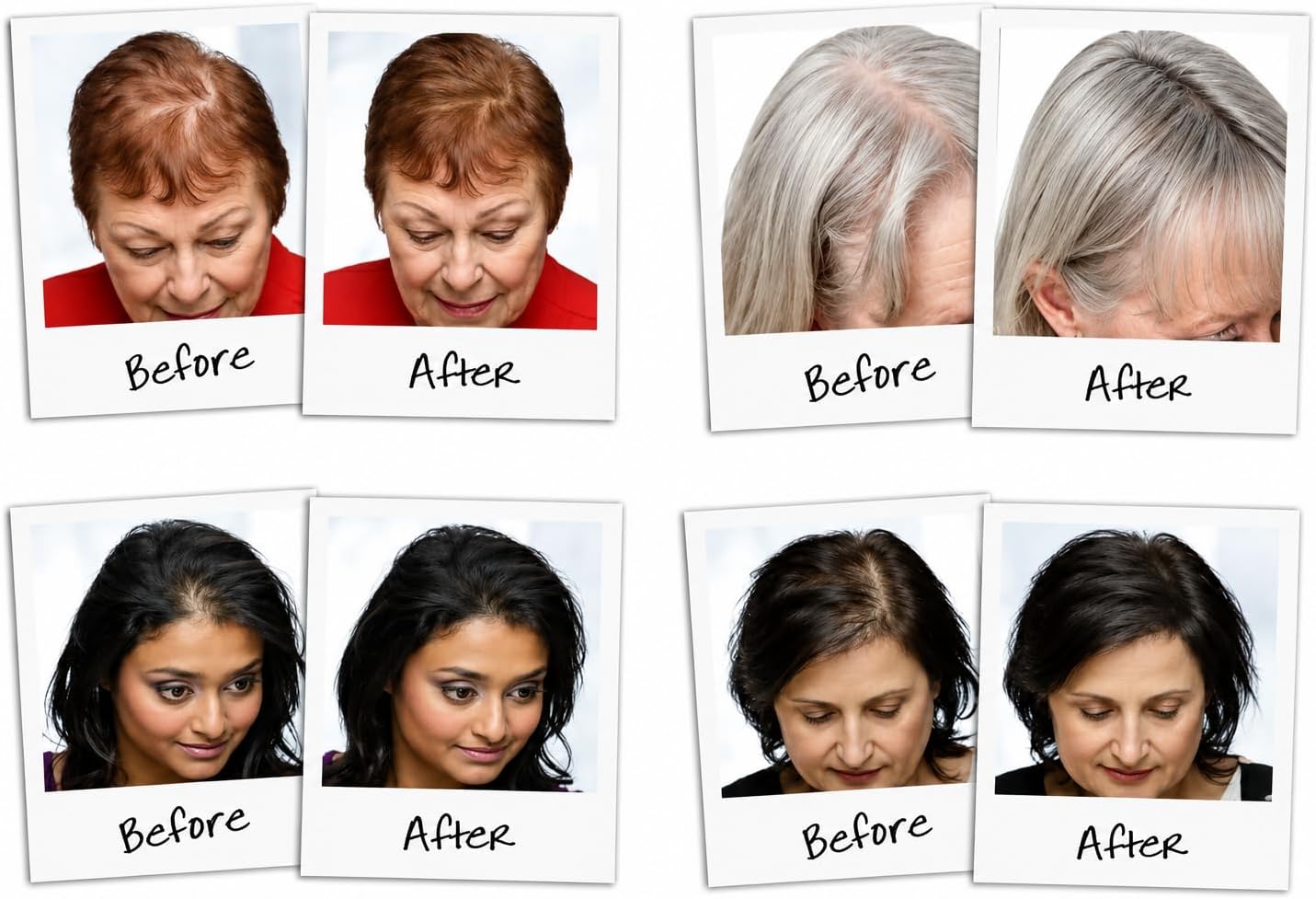 Six before-and-after hair density and scalp visibility comparison photos arranged in a grid, showing women with thinning hair and gray hair loss. Handwritten labels read 'Before' and 'After' beneath each portrait.