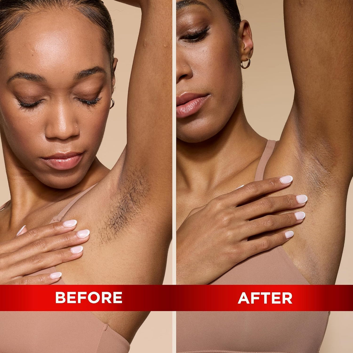 Before and after comparison of a woman's armpit hair on a beige background.
