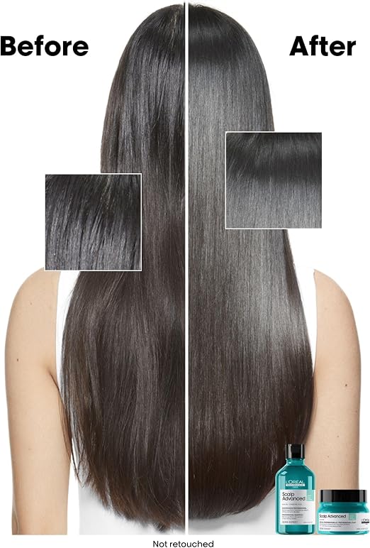 Before and after hair growth results on a woman's back, showing long, straight, dark brown hair. The left side labeled 'Before' shows shorter, darker hair with a texture inset, and the right side labeled 'After' shows significantly longer, smoother hair.