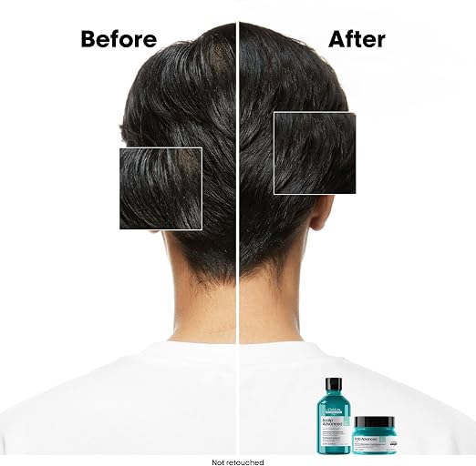 A split-screen before-and-after comparison showing the back of a person's head with dark hair, highlighting thicker, shinier hair in the 'After' section. Small teal and black haircare bottles are shown at the bottom right on a white background.