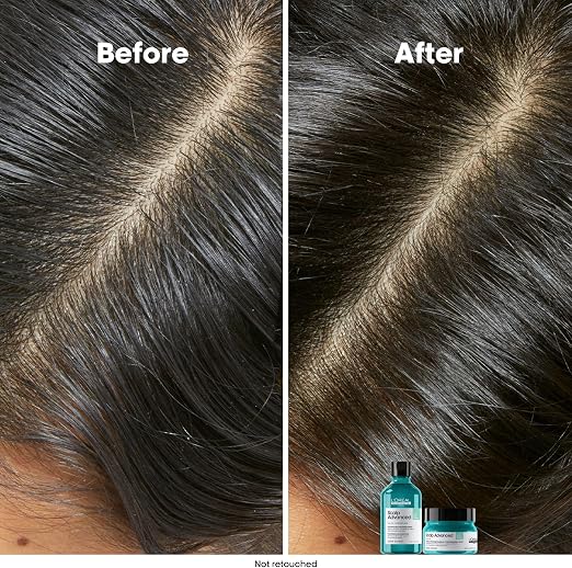 A side-by-side before and after comparison of a person's hair part line, showing darker, fuller-looking hair in the 'After' panel. Two small haircare product bottles and jars are visible at the bottom right.