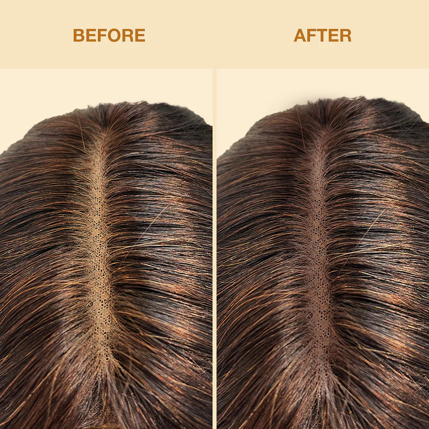 Before and after comparison of hair density on a beige background