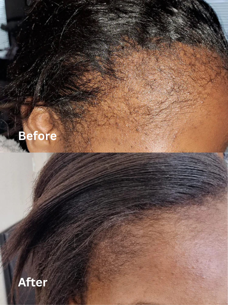 Before and after comparison of scalp and hair texture.