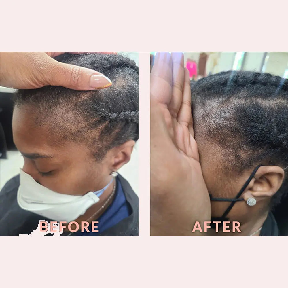 Design Essentials - Edge & Temple Strengthening Oil With Biotin And Black Castor