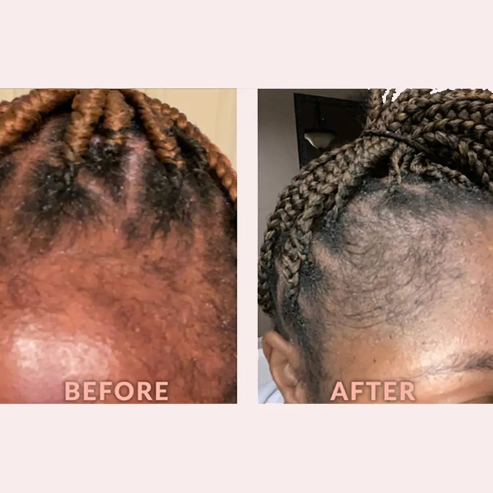Design Essentials - Edge & Temple Strengthening Oil With Biotin And Black Castor