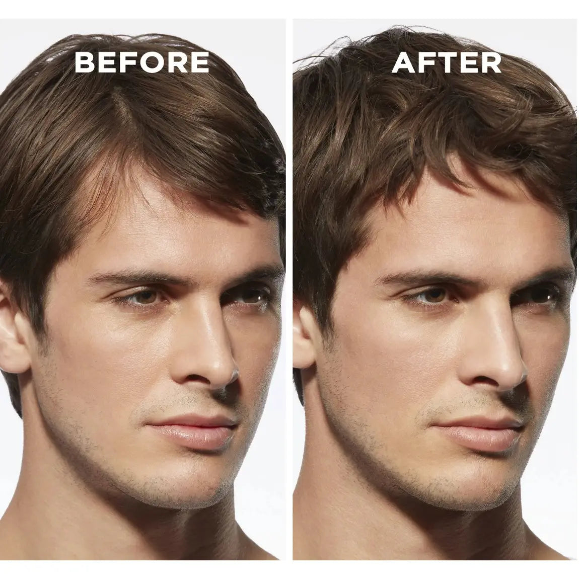 Kerastase - Anti Hair Fall Fortifying Serum