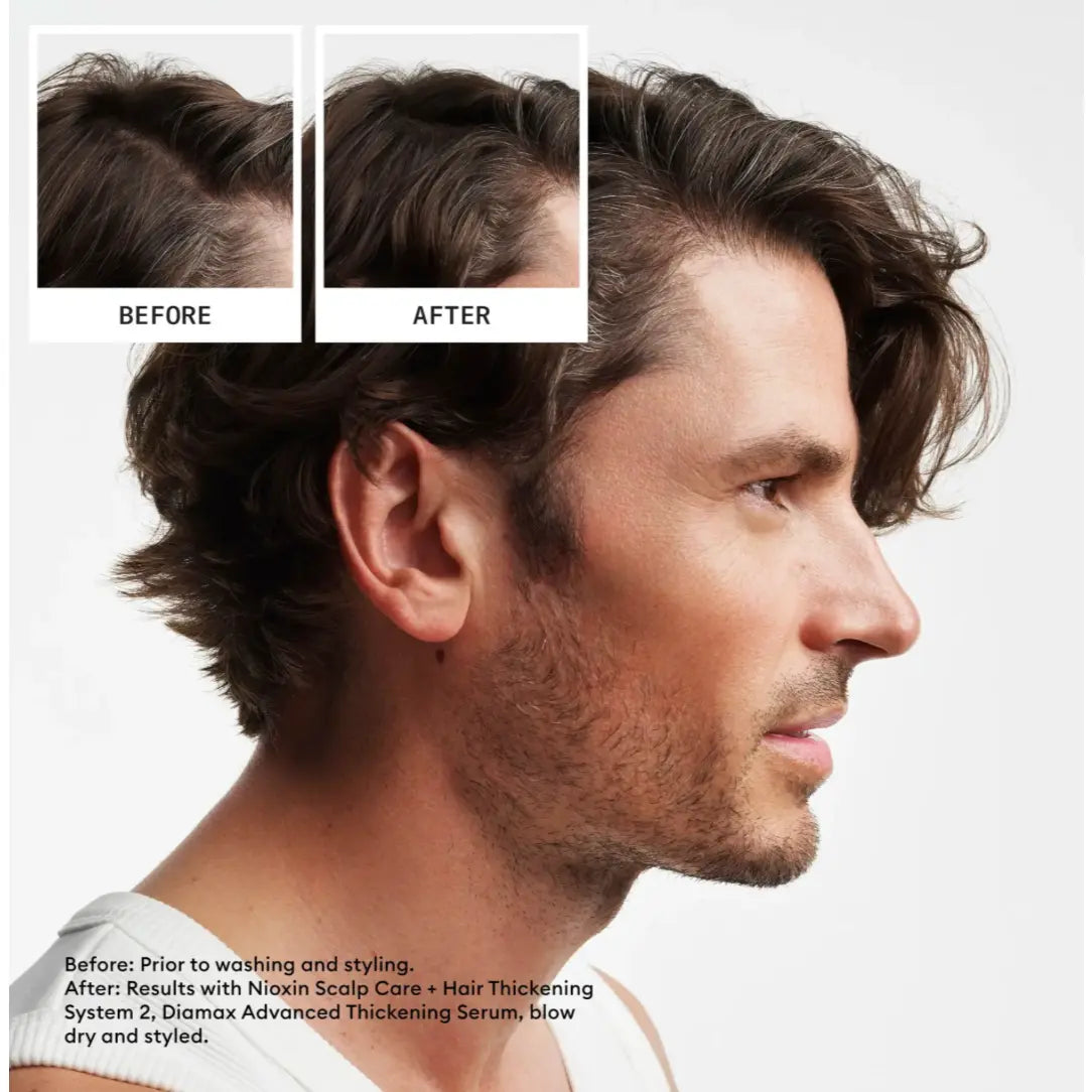 Nioxin - Kit System 2 For Natural Hair With Progressed Thinning